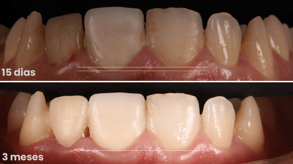 Estética e Harmonia